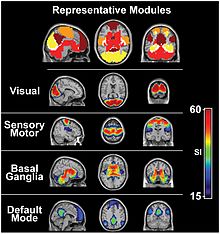 mri showing the body's energy in the brain 